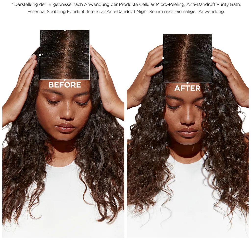 Kérastase Symbiose Bain Crème Anti-Pelliculaire